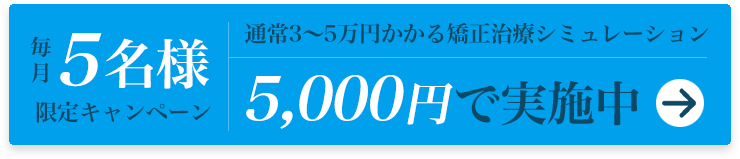 毎月5名様限定キャンペーン 通常3～5万円かかる矯正治療シミュレーション5,000円で実施中