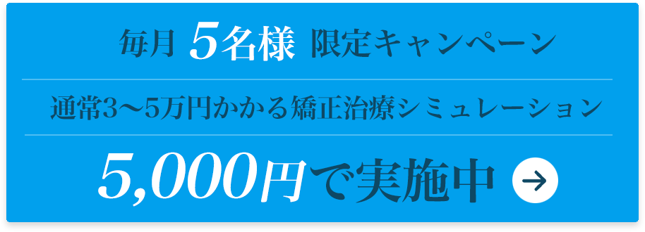 毎月5名様限定キャンペーン 通常3～5万円かかる矯正治療シミュレーション5,000円で実施中