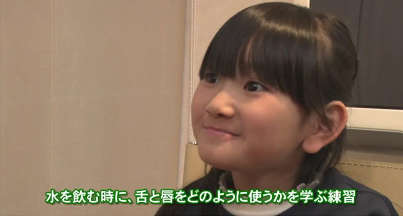 小児矯正（マイオブレース矯正）について